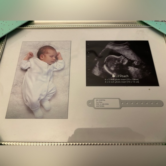 Accessories - Ultrasound & bracelet frame.